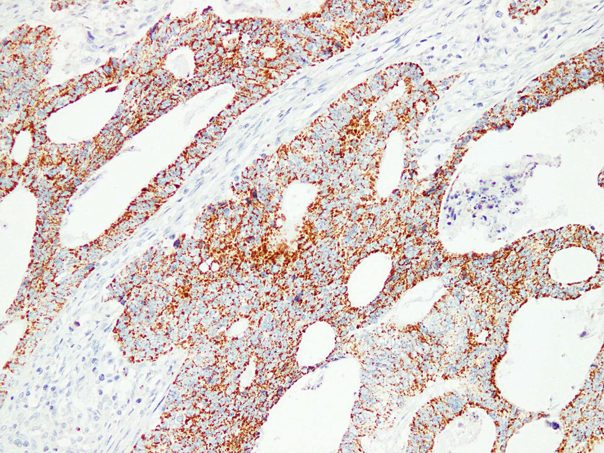 Monoclonal Mouse anti-Human HSPD1 / HSP60 Antibody (clone ABT-HSP60, IHC)