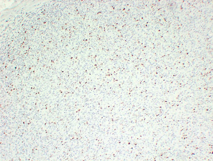 MKI67 / Ki67 Antibody (clone ABT-KI67)