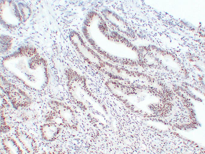 MSH6 Antibody (clone ABT-MSH6)