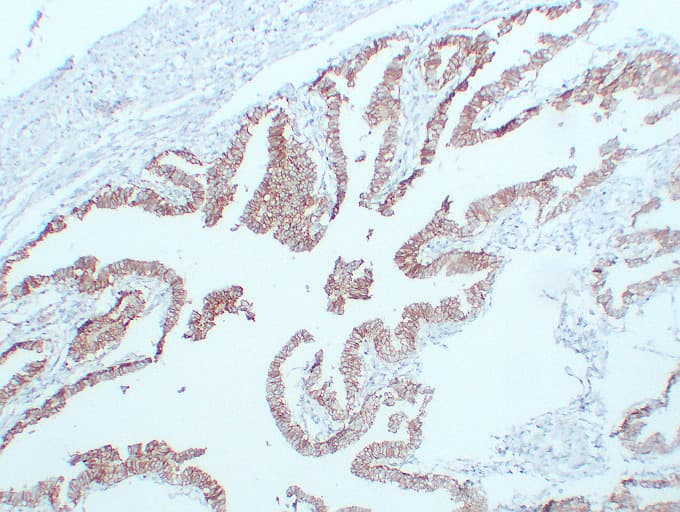 Monoclonal Mouse anti-Human CDH2 / N Cadherin Antibody (clone ABT-CDH2, IHC, WB)