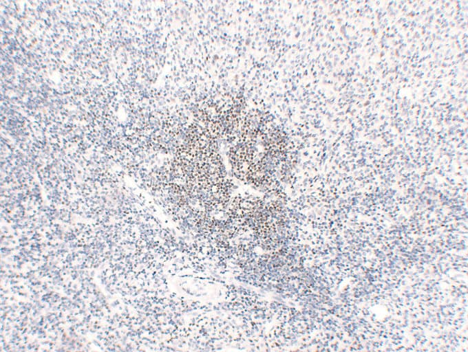 POU2F2 / OCT2 Antibody (clone ABT-OCT2)