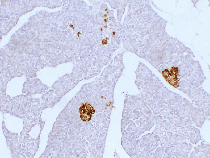 Monoclonal Mouse anti-Human SYP / Synaptophysin Antibody (clone ABT-SYN, IHC)