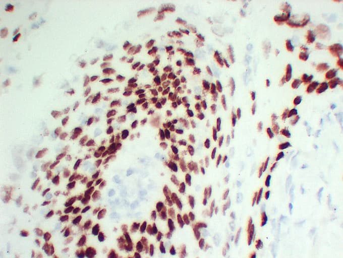TP63 / p63 Antibody (clone ABT-P40)