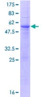Human TCRA Protein (Recombinant GST)