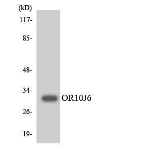 Polyclonal Rabbit anti-Human OR10J6P Antibody (WB)
