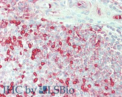 Polyclonal Goat anti-Human CA1 / Carbonic Anhydrase I Antibody (Liquid, IHC, WB)