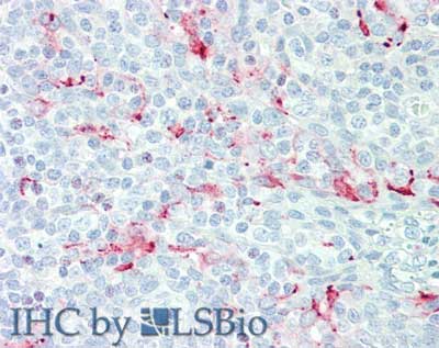 MSLN / Mesothelin Antibody (clone MN-1)