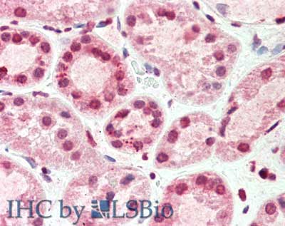 Monoclonal Mouse anti-Human TIMP4 Antibody (clone 9:4-7, IHC, WB)