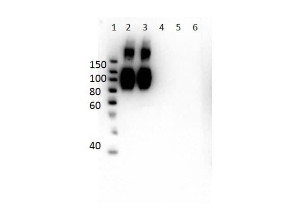 HBB / Hemoglobin Beta Antibody (N-Terminus, clone 14G2.G11.F11)