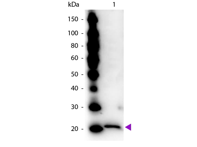 Ferritin Antibody (Liquid)