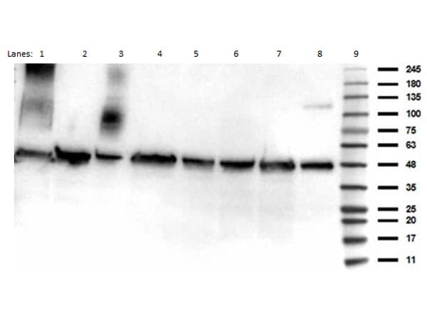 Polyclonal Rabbit anti-Human TP53 / p53 Antibody (Ac-Lys292, WB)