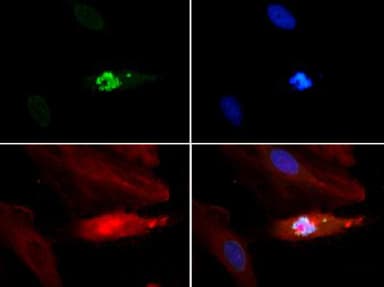 HIST3H3 Antibody (phospho-Thr3/Me-Lys4)