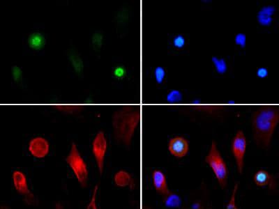 Polyclonal Rabbit anti-Human HIST3H3 Antibody (phospho-Thr3/Ac-Lys4, IHC, IF, WB)