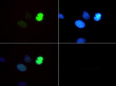Polyclonal Rabbit anti-Human HIST3H3 Antibody (Me-Lys4/pThr6, IHC, IF, WB)