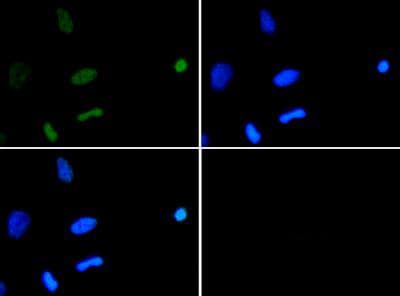 Polyclonal Rabbit anti-Human HIST3H3 Antibody (Ac-Lys18, IHC, IF, WB)