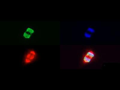 Polyclonal Rabbit anti-Human HIST3H3 Antibody (Me3-Lys27/pThr28, IHC, IF, WB)
