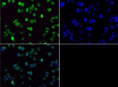 Polyclonal Rabbit anti-Human HIST3H3 Antibody (Me2-Lys36, IHC, IF, WB)