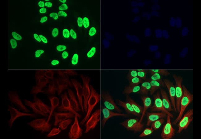 HIST3H3 Antibody (Ac-Lys36)