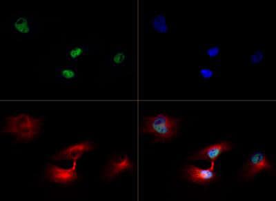 Polyclonal Rabbit anti-Human HIST3H3 Antibody (Me3-Lys79, IHC, IF, WB)