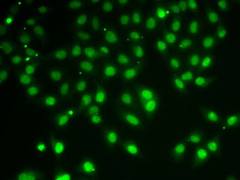Polyclonal Rabbit anti-Human HDAC5 Antibody (IHC, IF, WB)