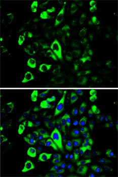 Polyclonal Rabbit anti-Human SQSTM1 Antibody (IHC, IF, WB)