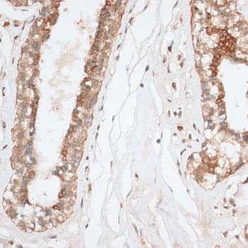 BCL2 / Bcl-2 Antibody