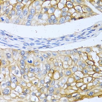 Polyclonal Rabbit anti-Human BMP4 Antibody (IHC, IF)