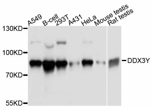 Polyclonal Rabbit anti-Human DDX3Y Antibody (IHC, WB)