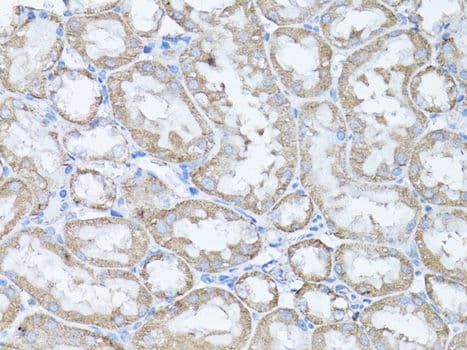 Polyclonal Rabbit anti-Human SNAI1 / SNAIL-1 Antibody (IHC, WB)