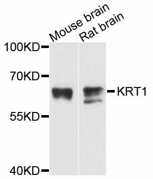 Polyclonal Rabbit anti-Human KRT1 / CK1 / Cytokeratin 1 Antibody (WB)
