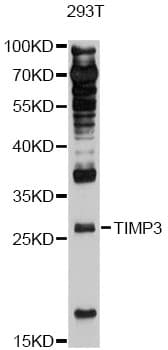 Polyclonal Rabbit anti-Human TIMP3 Antibody (WB)