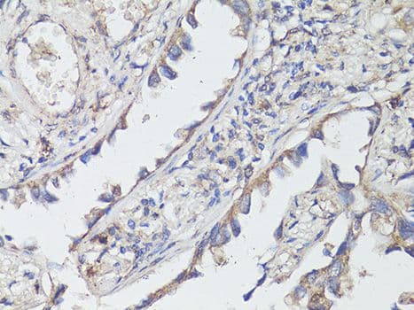 Polyclonal Rabbit anti-Human NTRK2 / TRKB Antibody (IHC, WB)