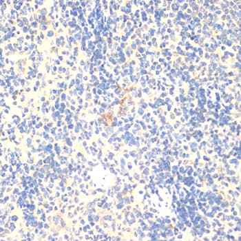 Polyclonal Rabbit anti-Human FOXP3 Antibody (IHC, WB)