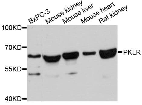 Polyclonal Rabbit anti-Human PKLR Antibody (WB)