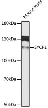 Polyclonal Rabbit anti-Human SCP1 / SYCP1 Antibody (WB)