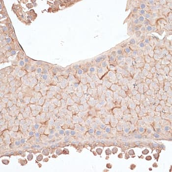Polyclonal Rabbit anti-Human KIAA1524 / p90 Autoantigen Antibody (IHC, WB)
