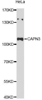 Polyclonal Rabbit anti-Human CAPN3 / Calpain 3 Antibody (WB)