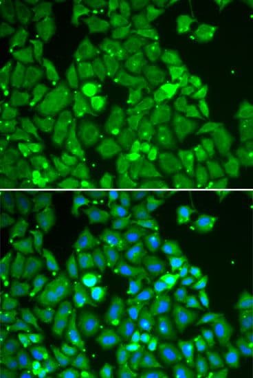 Polyclonal Rabbit anti-Human STAT1 Antibody (IF, WB)