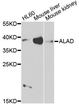 Polyclonal Rabbit anti-Human ALAD Antibody (IF, WB)