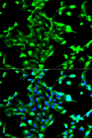 Polyclonal Rabbit anti-Human ANXA2 / Annexin A2 Antibody (IHC, IF, WB)