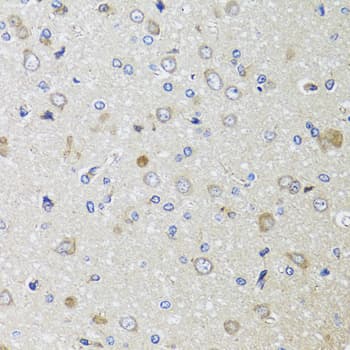Polyclonal Rabbit anti-Human B2M / Beta 2 Microglobulin Antibody (IHC, WB)