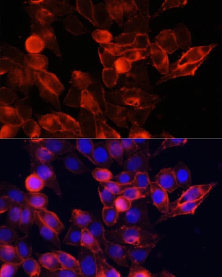 Polyclonal Rabbit anti-Human CD44 Antibody (IHC, IF, WB)