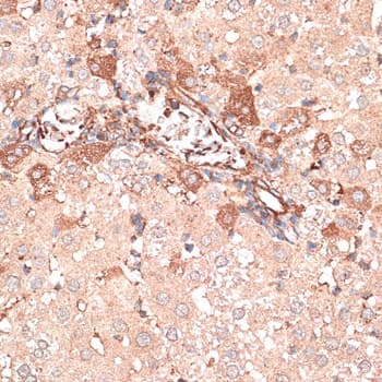 Polyclonal Rabbit anti-Human KTN1 / Kinectin Antibody (IHC, WB)