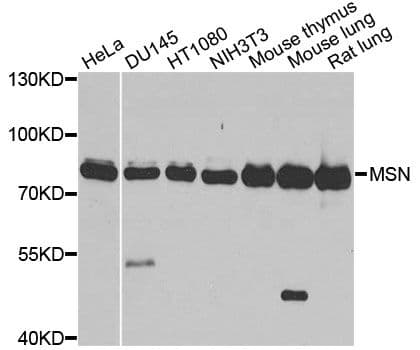 Polyclonal Rabbit anti-Human MSN / Moesin Antibody (WB)