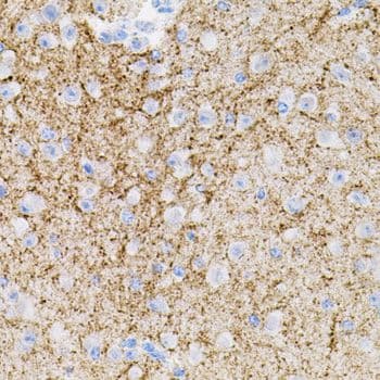 Polyclonal Rabbit anti-Human NTF3 / Neurotrophin 3 Antibody (IHC, WB)