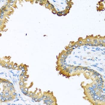 Polyclonal Rabbit anti-Human VEGFC Antibody (IHC, WB)