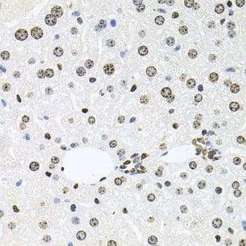 Polyclonal Rabbit anti-Human HDAC3 Antibody (IHC, WB)
