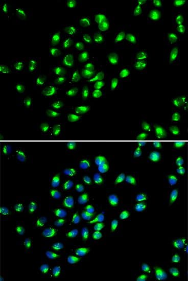 Polyclonal Rabbit anti-Human GOLM1 / GP73 / GOLPH2 Antibody (IHC, IF, WB)