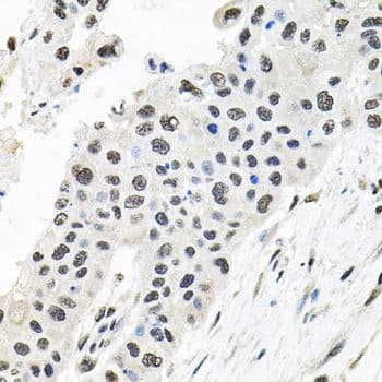 Polyclonal Rabbit anti-Human CDCA8 / Borealin Antibody (IHC, WB)
