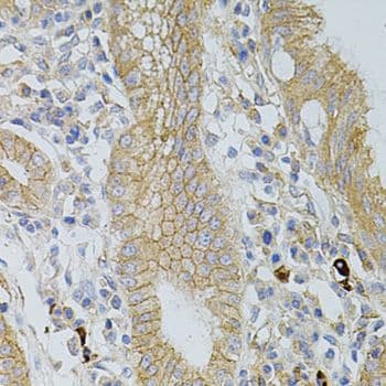 Polyclonal Rabbit anti-Human OCLN / Occludin Antibody (IHC, WB)